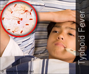 what is typhoid fever image