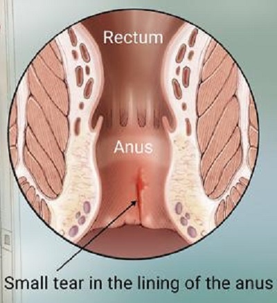 What is anus