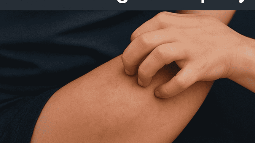 A Cured Case of Severe Itching With Homeopathy